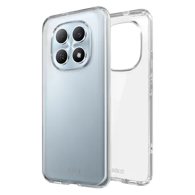 Cover Skinny für Xiaomi Redmi Note 15